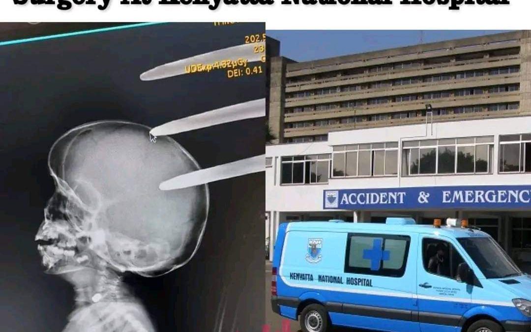 Mother of a two year old boy who had a fork jembe logged in his skull tells her story